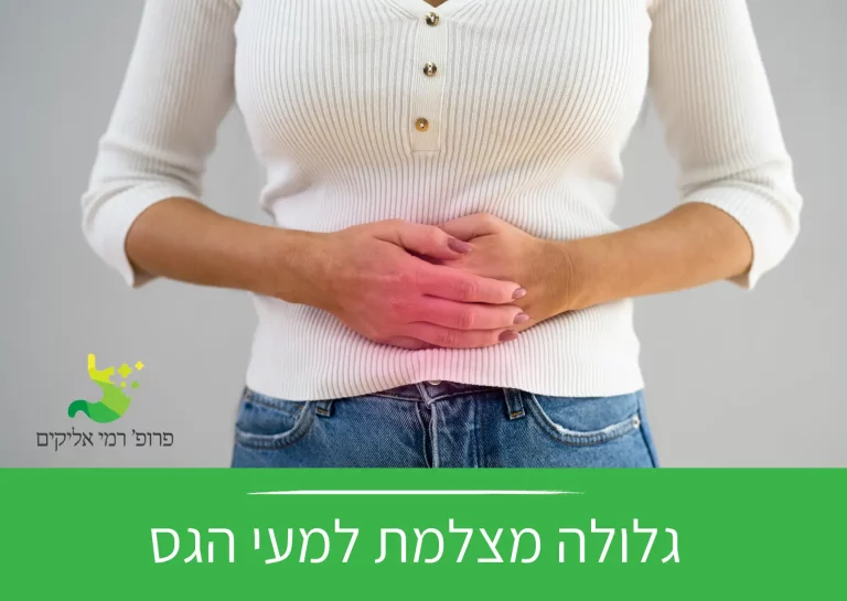 גלולה מצלמת | מומחה לגסטרואנטרולוגיה פרופ' רמי אליקים